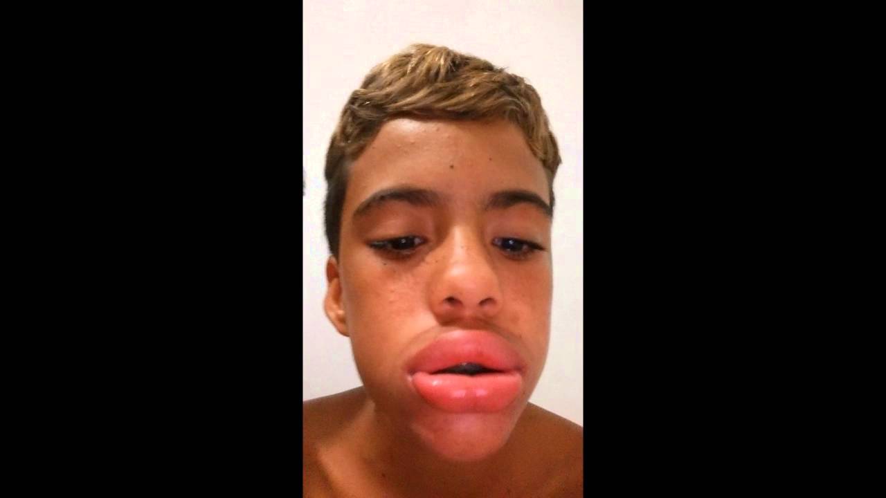 O Que E Boca De Sacola