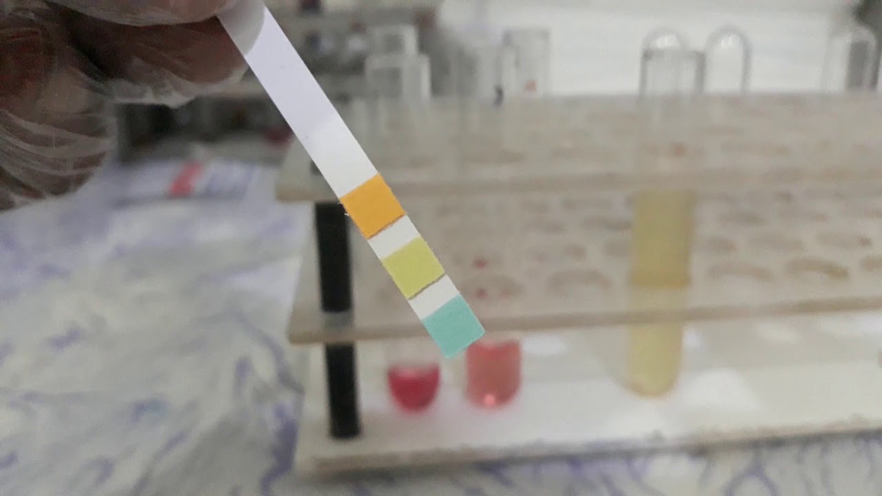 Urine Albumin Test - YouTube What Is Normal Albumin In Urine