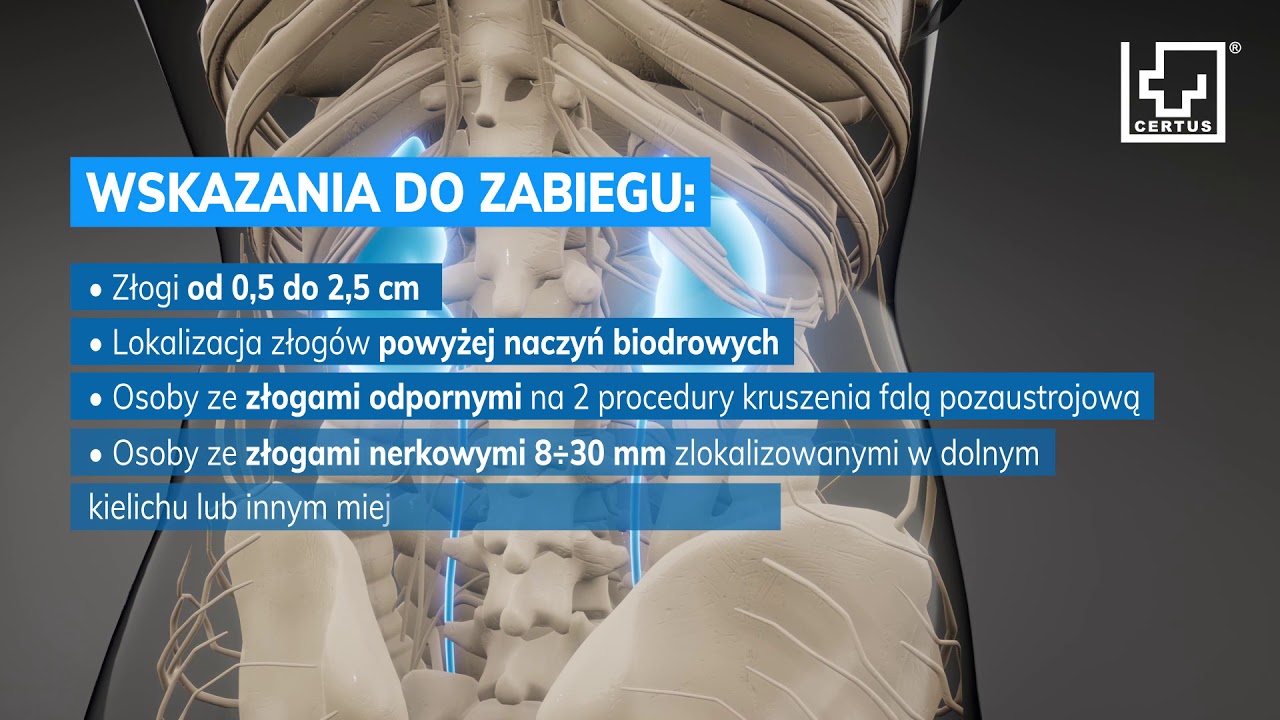 Usuwanie Kamieni Nerkowych Przez Cewke Moczowa Film