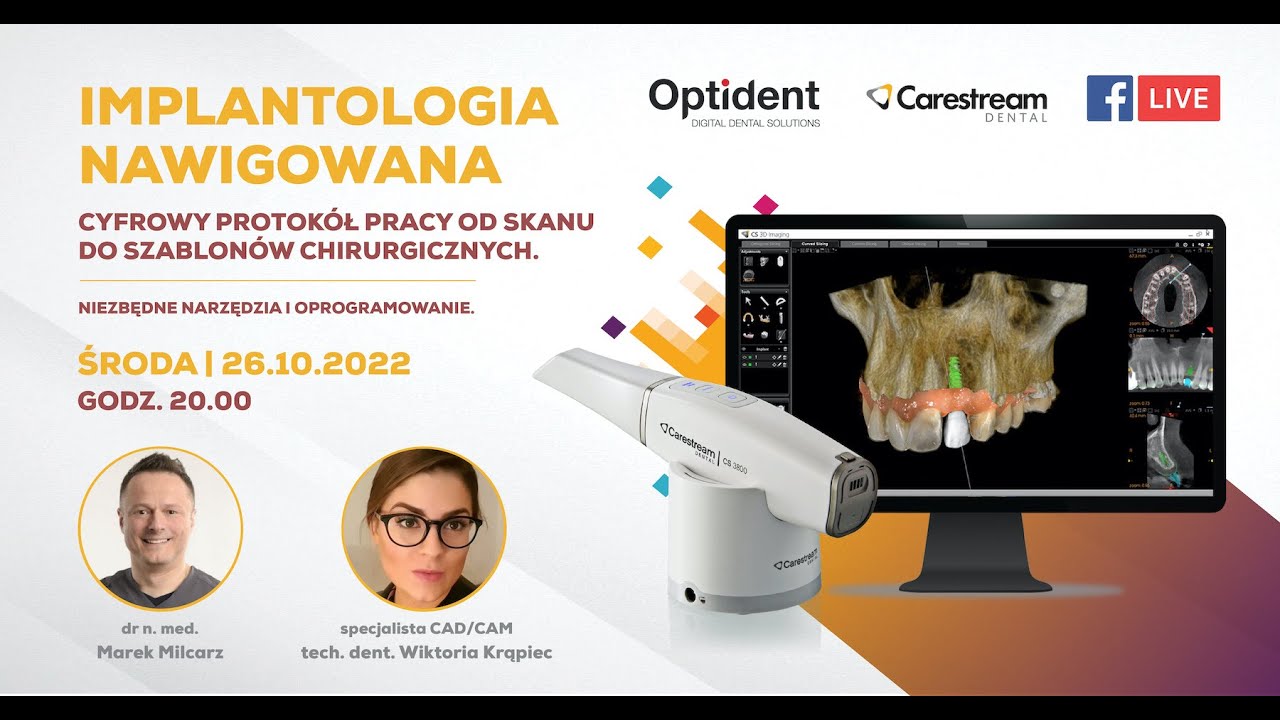 WEBINAR: Implantologia nawigowana - dr n. med. Marek Milcarz, tech Dr N Med Marek Litmanowicz