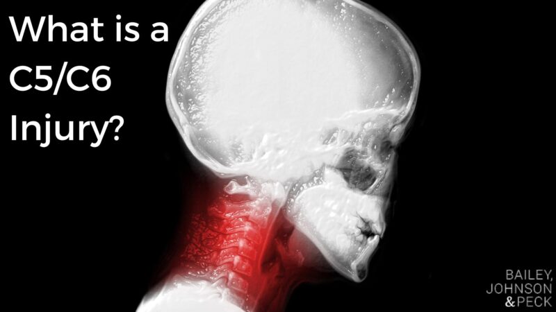 What is a C5/C6 Injury? | Bailey, Johnson & Peck, P.C. Czy święta Państwowe Są Płatne 2019