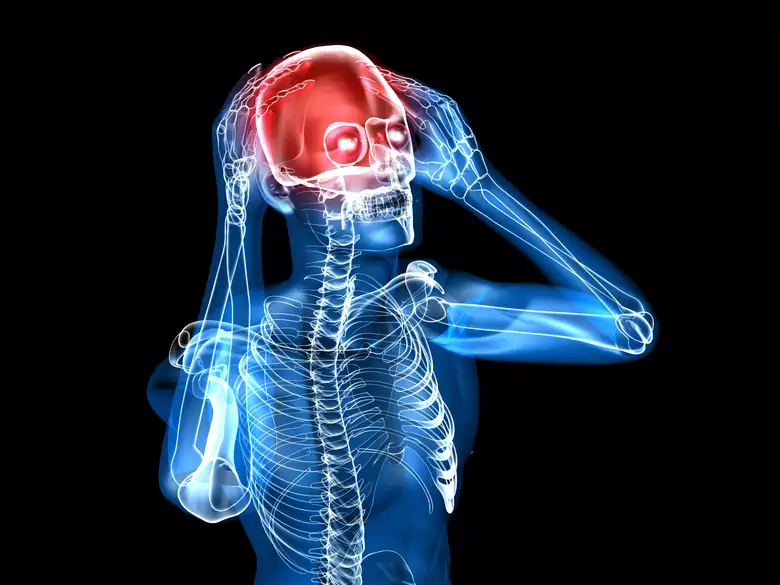 Wstrząśnienie mózgu - czy jest niebezpieczne? - ForumNeurologiczne.pl Ile Zwolnienia Po Wstrzasnieniu Mozgu