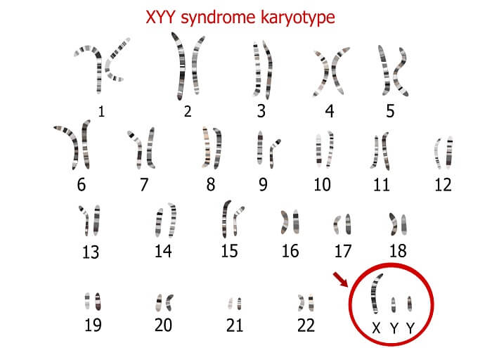 Y Chromosome - The Definitive Guide | Biology Dictionary Czy Przodkowie Człowieka Wywodzą Się Ze środkowej Azji