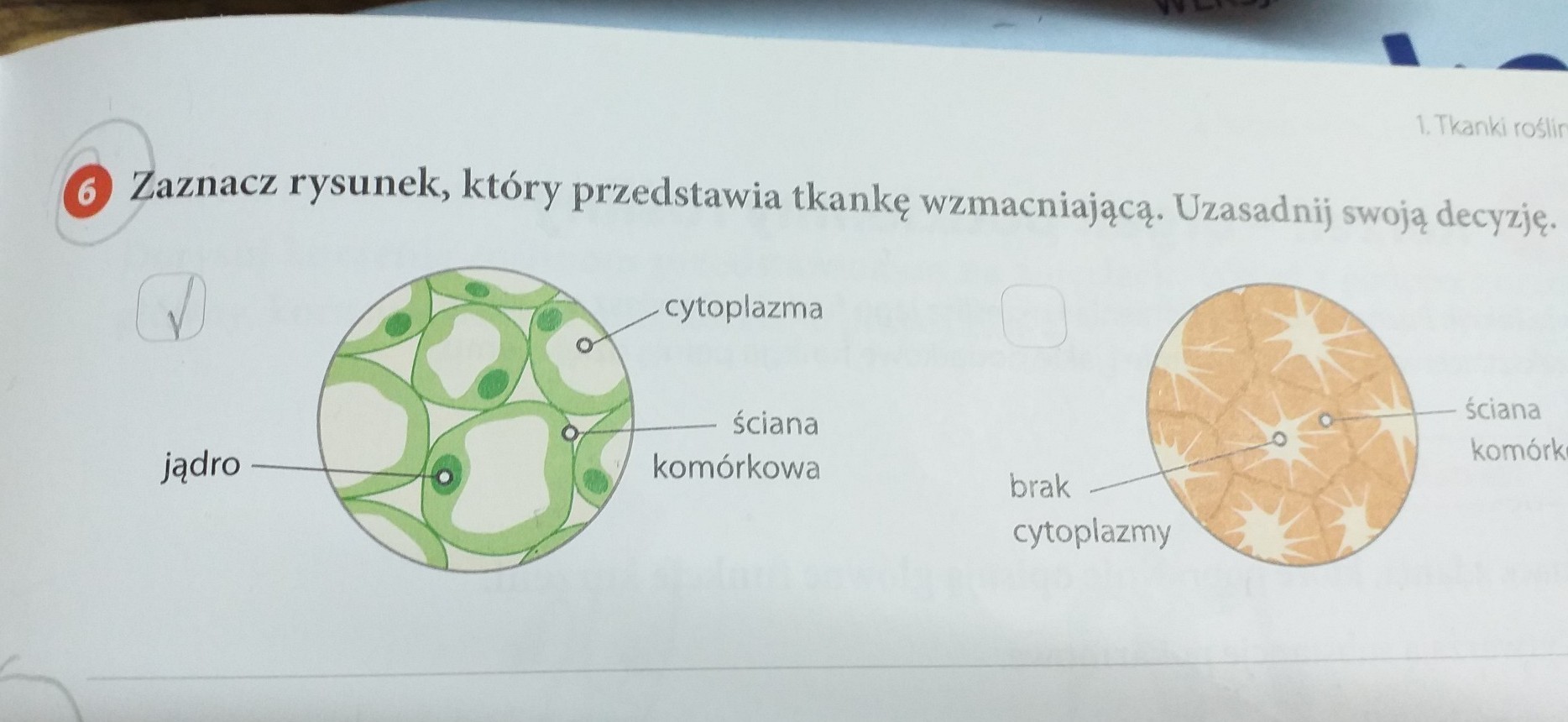 Zaznacz rysunek który przedstawia tkankę wzmacniającą Uzasadnij swoją Zaznacz Rysunek Ktory Przedstawia Tkanke Wzmacniajaca Uzasadnij Swoja Decyzje