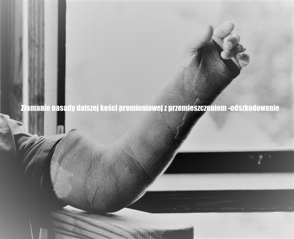 Złamanie nasady dalszej kości promieniowej z przemieszczeniem Złamanie Nasady Bliższej Kości Piszczelowej Odszkodowanie